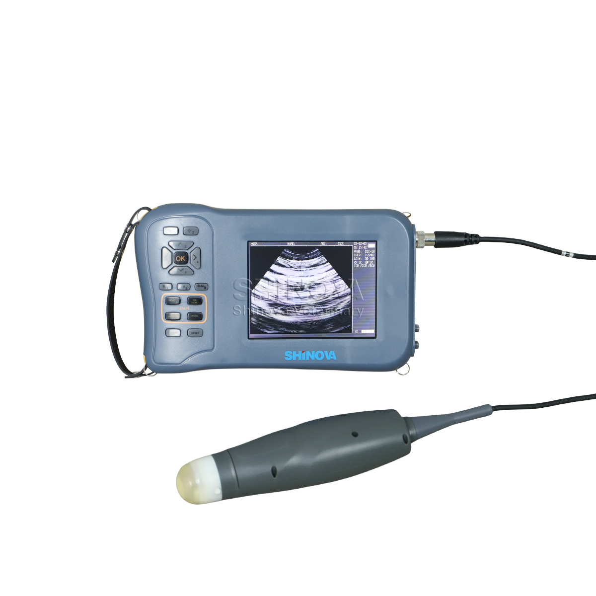 Handheld Veterinary Ultrasound Supporting USB 2.0